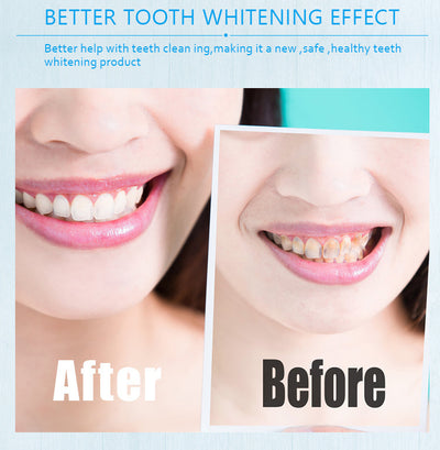 Toothbrush Cleaner beautiful Tooth Gel teeth Whitening Pen